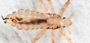 Head lice: detailed photos and features of the biology of parasites