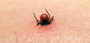 First aid for tick bites in humans