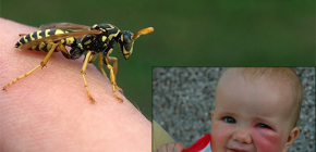 What to do if the child was suddenly bitten by a wasp