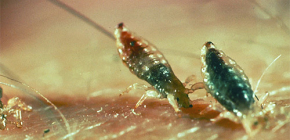 About human hypodermic lice: myths and reality