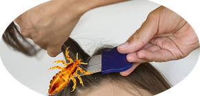 What to do if your child suddenly had lice ...