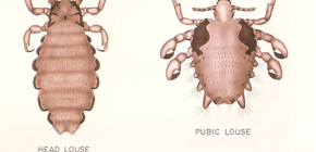 Details about lice in humans