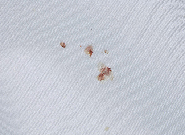 Blood stains on bedding