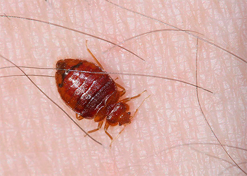 Meet the symptoms of bedbug bites