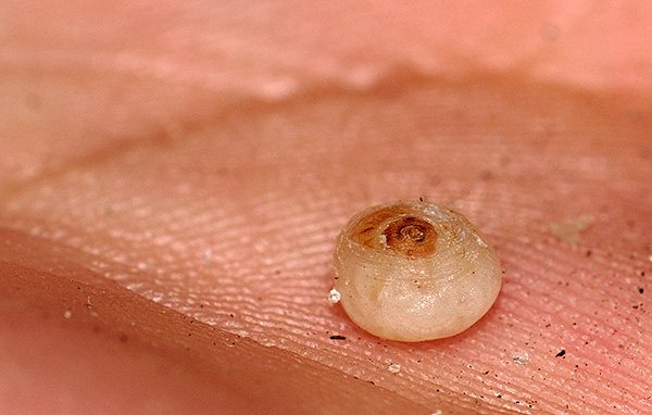 And this is what a sandy flea extracted from under the skin looks like - it is strongly swollen due to a large number of eggs ripening inside it.