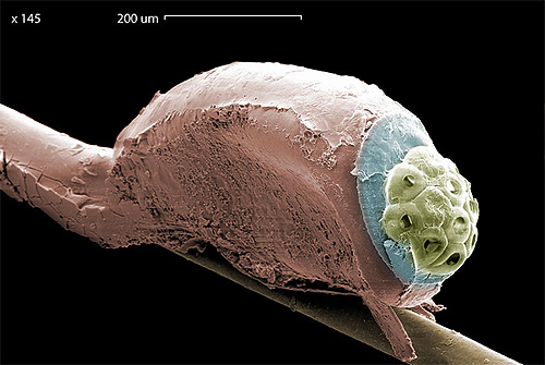 Foto av huvudet lus nits under ett elektronmikroskop