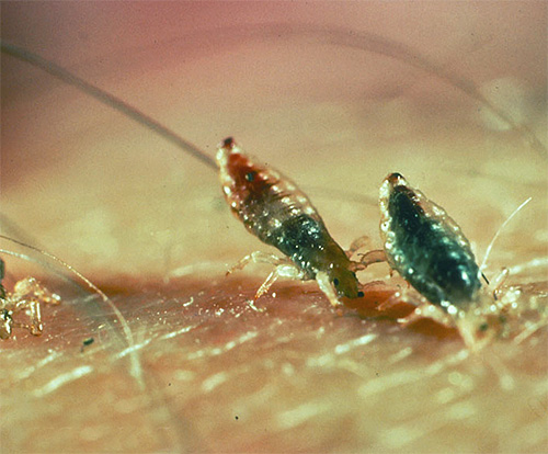 Do subcutaneous lice really exist or is it just a myth? Let's understand ...