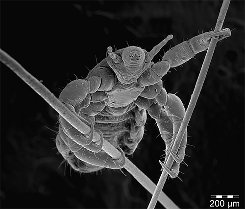 Due to the hooks on the legs, the head louse is firmly held on the hair.
