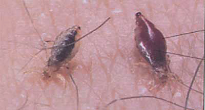 On the photo - bed lice during a bite