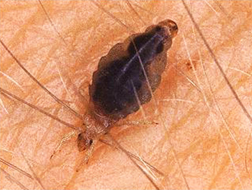 Linen louse on the skin at the time of the bite