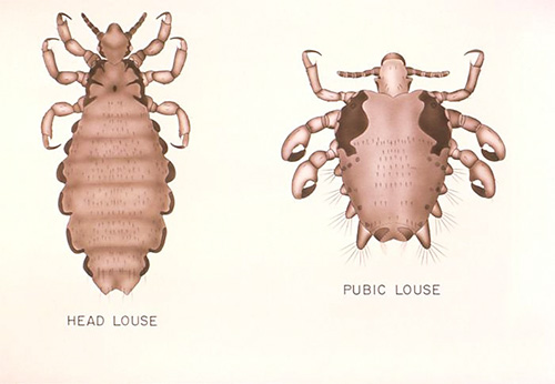 Each type of lice in humans has its own interesting features.