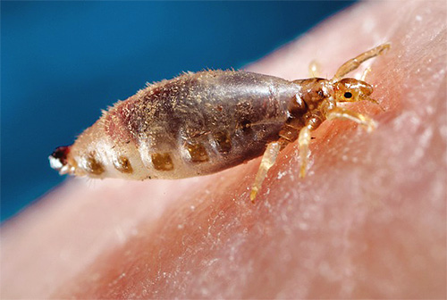 Louse on human skin while being bitten