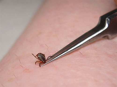 The procedure for extracting mite from the body