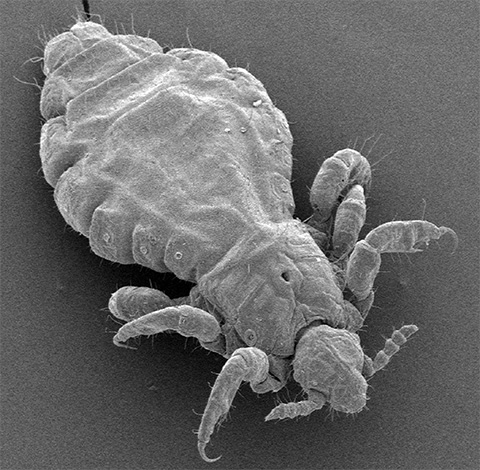 Head louse under the microscope