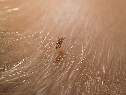 Head louse on hair