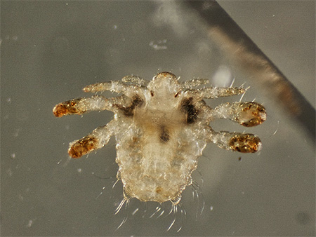 Photo of a pubic louse close up