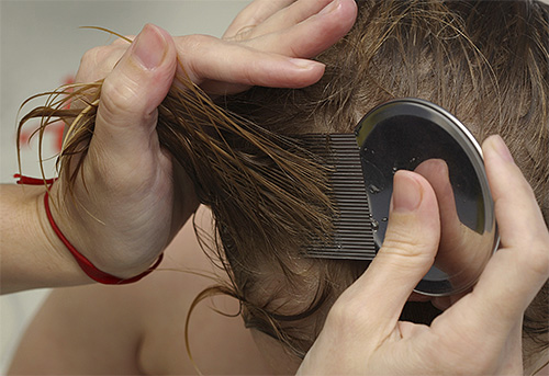 With the help of special combs for lice can effectively remove nits from the hair