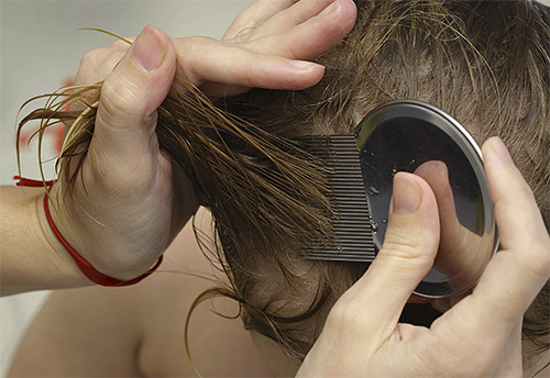 It is necessary to start combing lice and nits with a comb from the very roots of the hair.