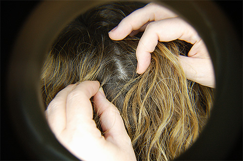 Regular examination of the hair will help to detect infection with lice at an early stage.