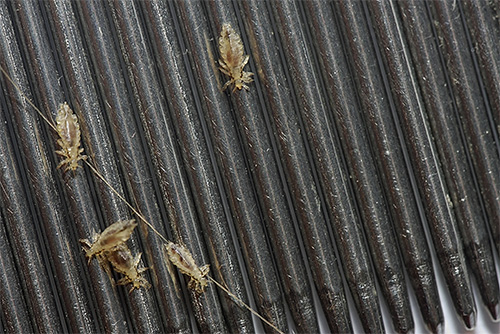 The photo shows lice combed out with a comb.