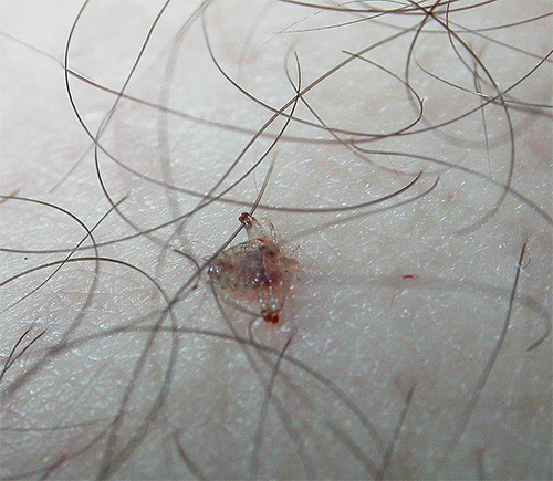 Pubic louse on body