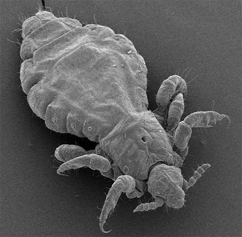 It looks like a head louse under an electron microscope