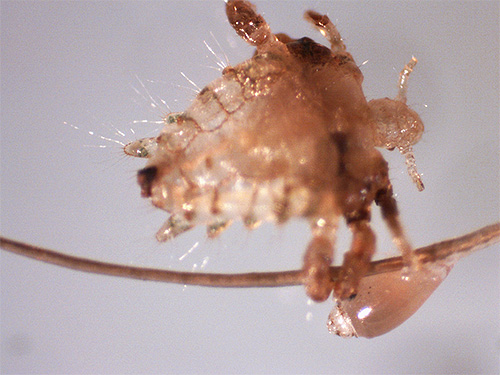 Photo of pubic louse with nits