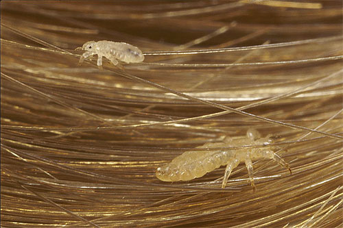 Lus på håret - den vanligaste bilden av dessa parasiter i drömmar