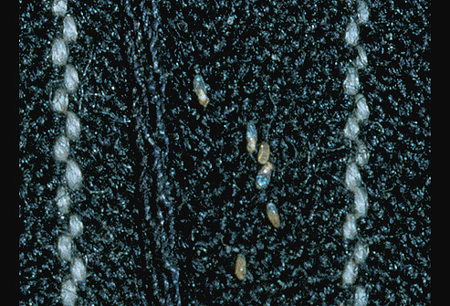 Accumulation of nits of linen louses on clothes