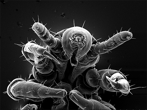Louse under an electron microscope