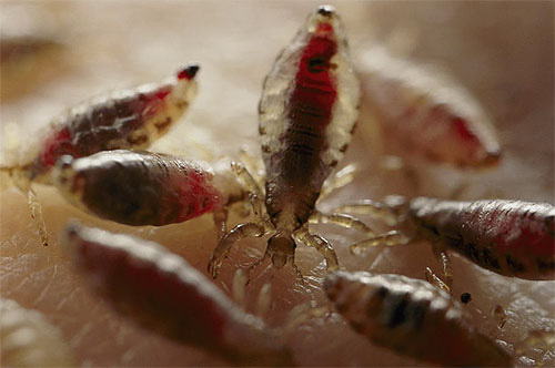 Each louse sucks up not much blood during feeding, but with a large number of parasites and massive bites, such blood loss can be significant.