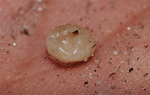 In the photo - female sand flea, extracted from under the skin at the site of the bite.