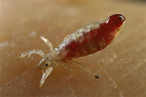 Louse during a bite: it is clear that the belly of the parasite is filled with blood
