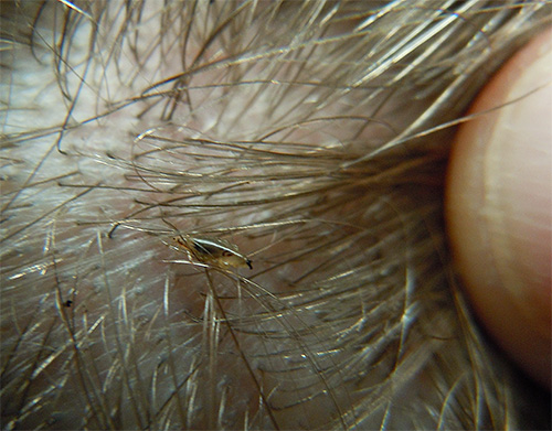 With careful inspection of the head lice can almost always be visually detected.