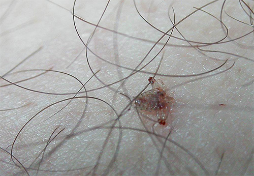 Photos of pubic lice on the body