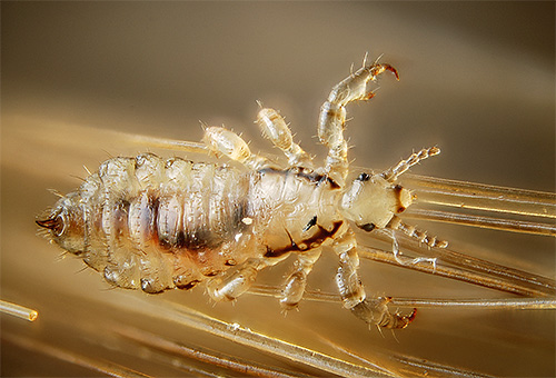 The photo shows the head louse with a significant increase