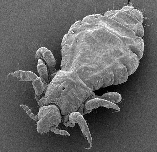 Head louse under the microscope