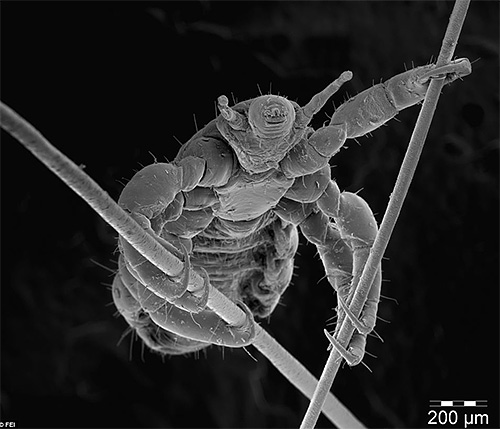 Head louse on hair under a microscope