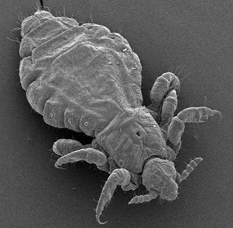 Another photo of a head louse taken under an electron microscope
