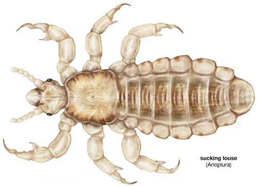 The picture clearly shows the structure of the body of the head louse.