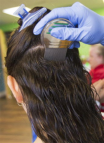 After shampooing with a special insecticidal shampoo,it is desirable to additionally comb out lice and nits with a comb