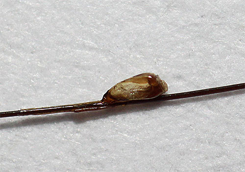 Även när lusklarven lämnar näten, fortsätter skalet att hänga på håret (torra nits).