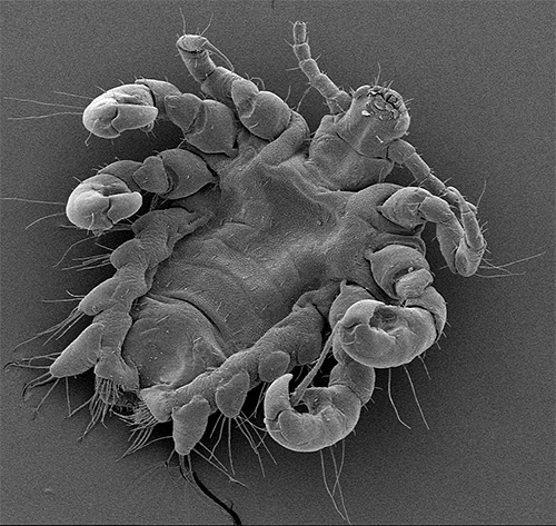 Another photo of pubic lice under an electron microscope