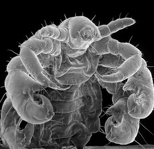 It looks like a pubic louse under an electron microscope