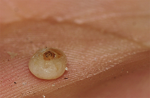 Bilden visar tydligt kroppen av en sandlopp som svullits från ägg.