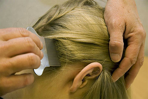 Lice and nits are combed from hair strand by strand.