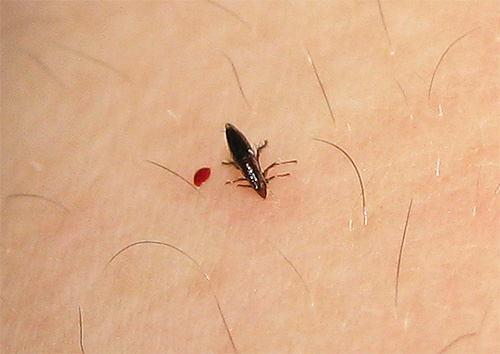 In the photo - a flea on the skin of a person at the time of the bite