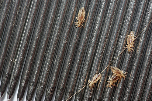 On a photo - the louses combed out from hair