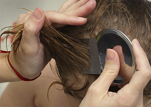 It is best to combine tar soap using a thick lice comb