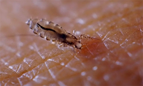 Getting on the skin and in the respiratory tract, Dichlorvos can cause even greater damage to human health than the lice themselves.